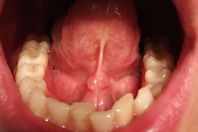 palate - example image