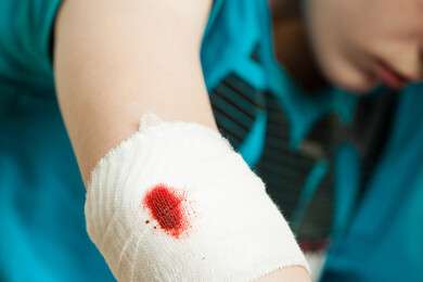 elbow - example image