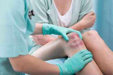 bruise - example image