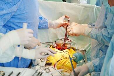 transplant - example image