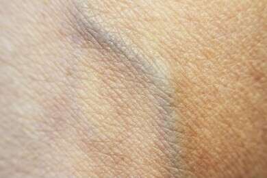 vein - example image