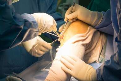 surgery - example image